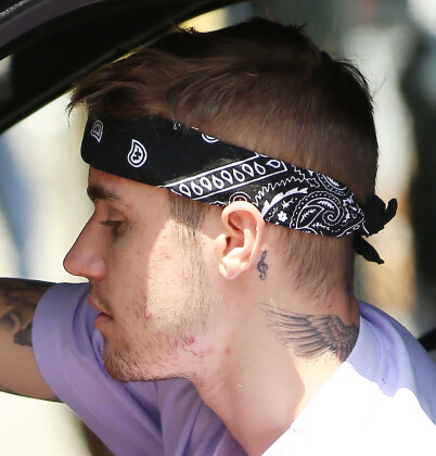 PROBLEMER MED AKNE: I ovennevnte intervju forteller Hailey Bieber at ektemannen sliter med akne i voksen alder. Foto: NTB Scanpix PROBLEMER MED AKNE: I ovennevnte intervju forteller Hailey Bieber at ektemannen sliter med akne i voksen alder. Foto: NTB Scanpix